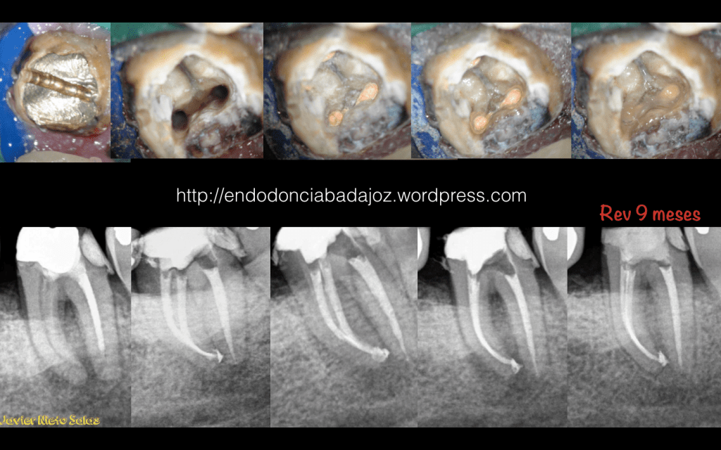 Captura de pantalla 2014-03-19 a la(s) 11.13.05