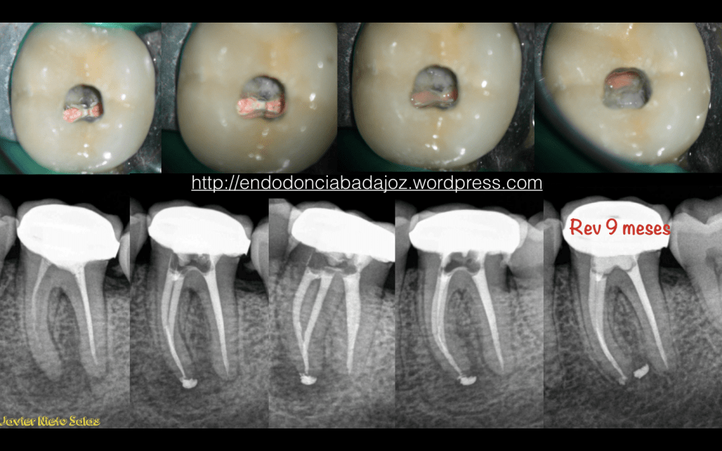 Captura de pantalla 2014-03-19 a la(s) 11.13.09