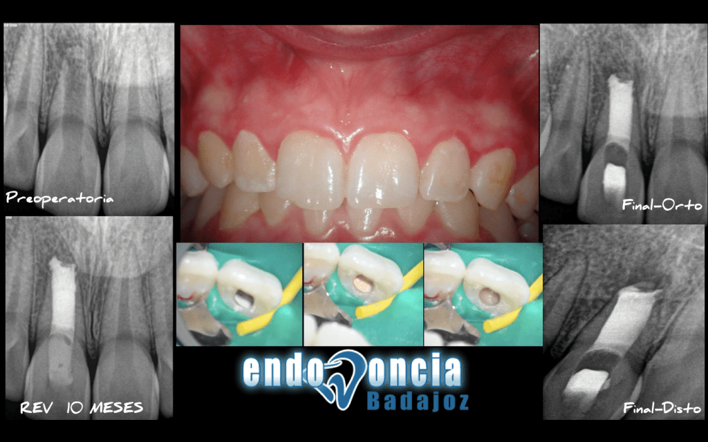 Captura de pantalla 2015-03-19 a las 17.59.20