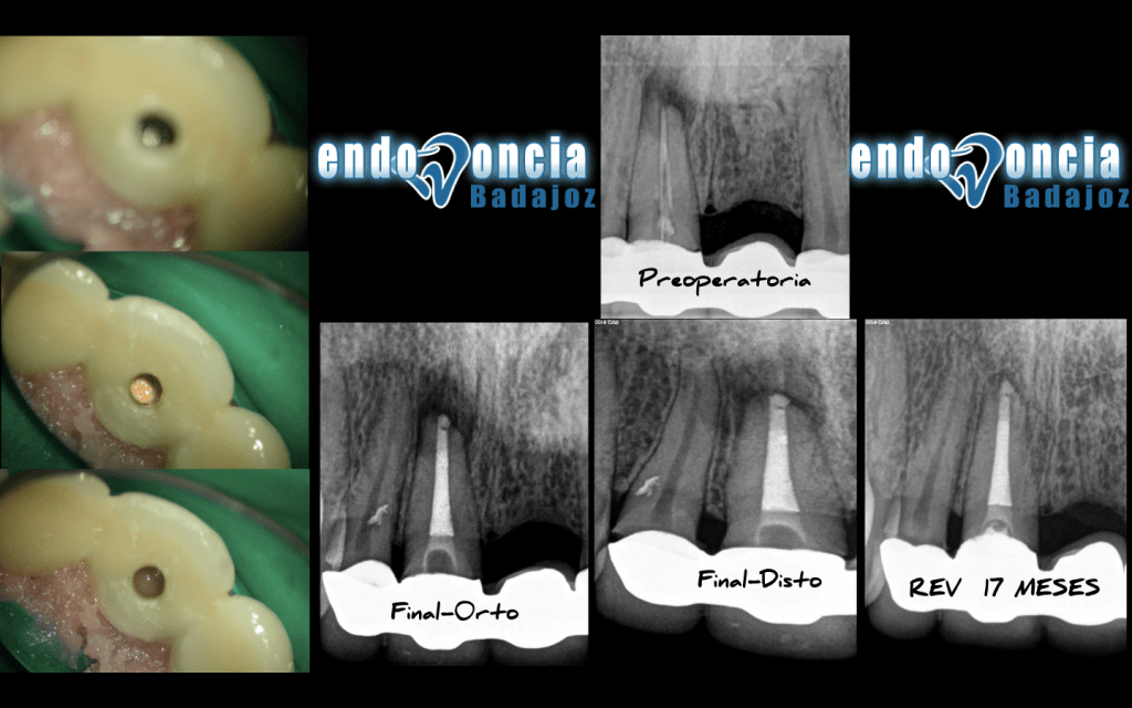 Captura de pantalla 2015-03-19 a las 17.59.22