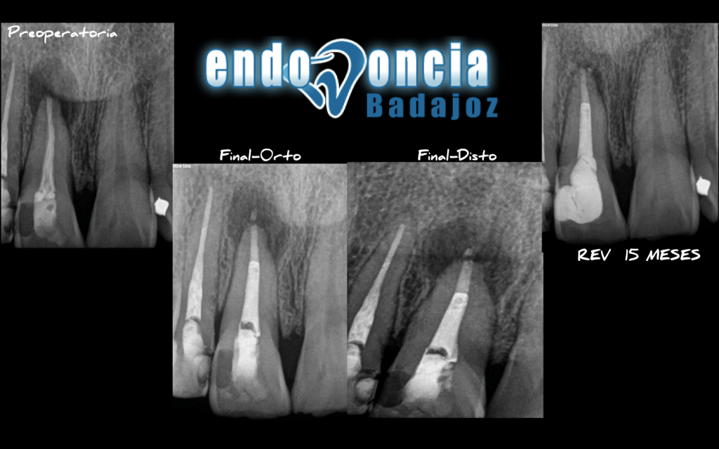 Captura de pantalla 2015-03-19 a las 17.59.24