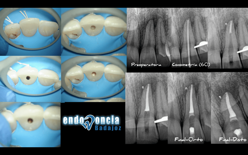 Captura de pantalla 2015-03-19 a las 17.59.28