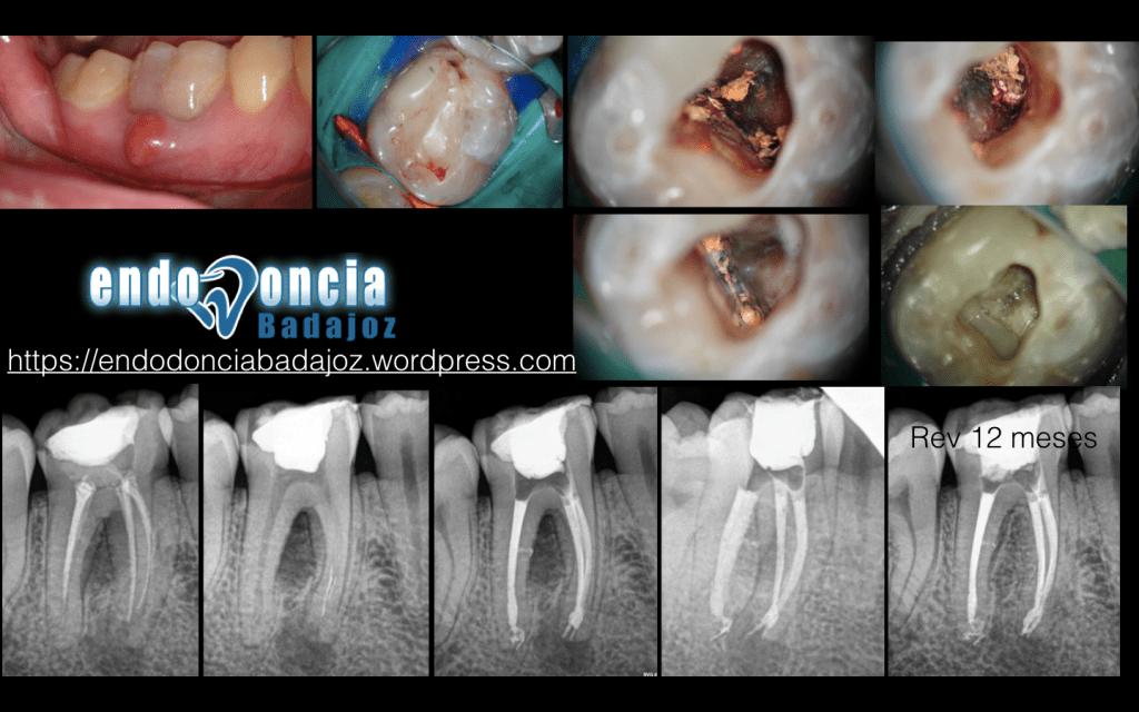 Captura de pantalla 2015-07-07 a las 16.25.10