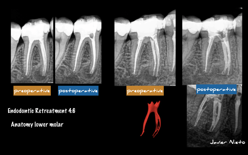 Captura de pantalla 2015-09-22 a las 16.57.14