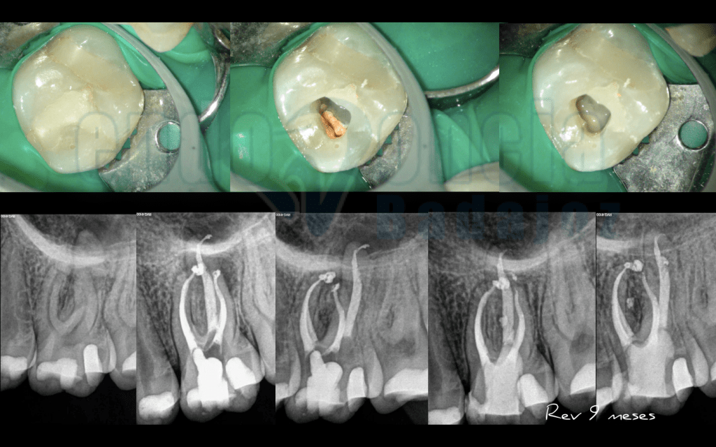 Captura de pantalla 2015-12-08 a las 11.26.50