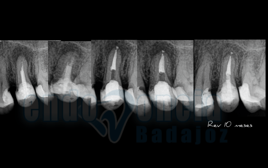 Captura de pantalla 2015-12-08 a las 11.26.52