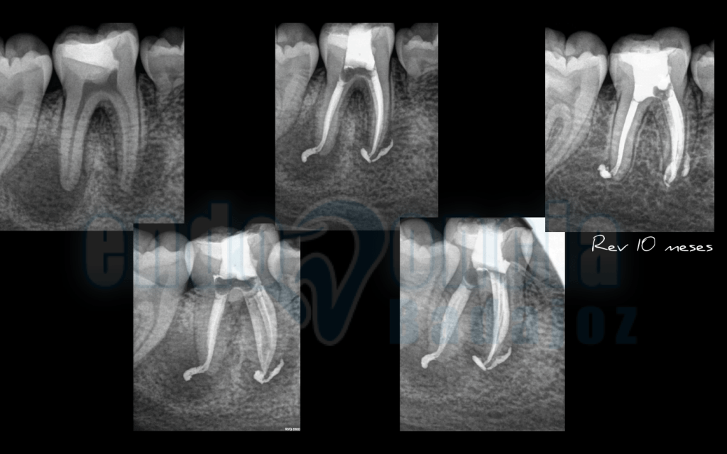 Captura de pantalla 2015-12-08 a las 11.26.54