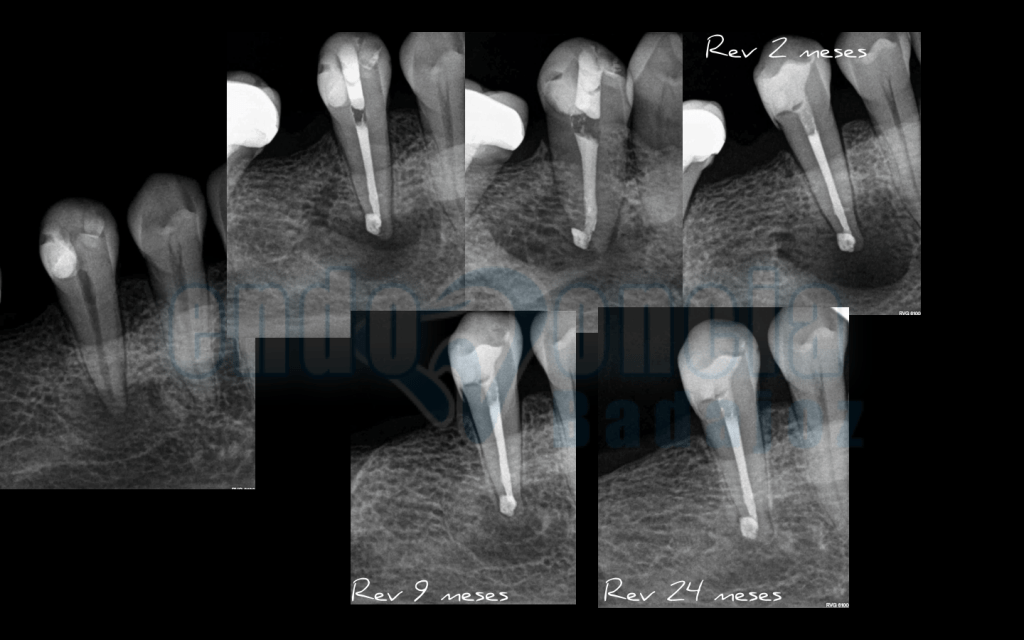 Captura de pantalla 2015-12-08 a las 11.26.56