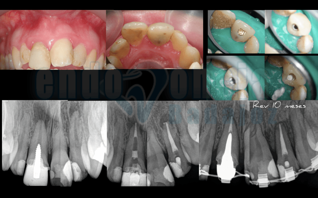 Captura de pantalla 2015-12-08 a las 11.26.58