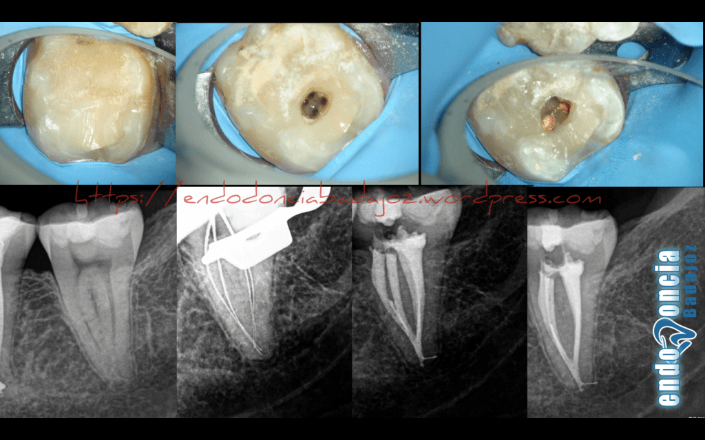 Captura de pantalla 2016-02-12 a las 13.21.43