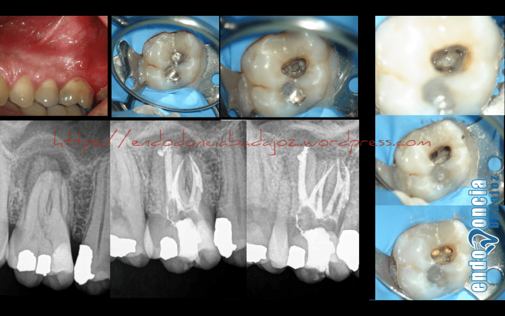 Captura de pantalla 2016-02-12 a las 14.10.22