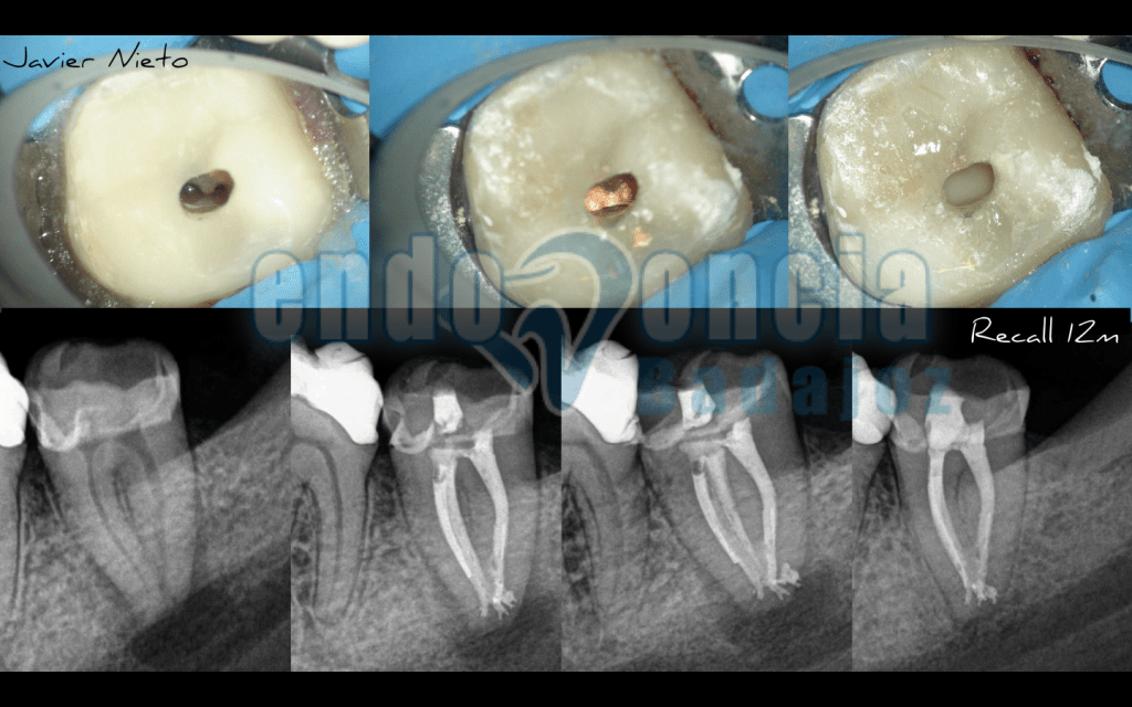 Captura de pantalla 2016-04-21 a las 17.59.17